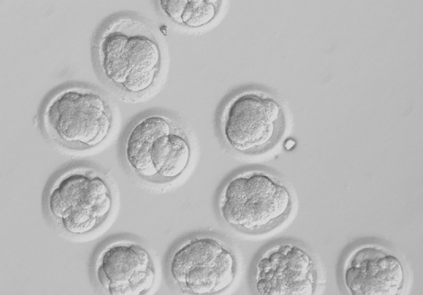 Human embryos created by somatic cell nuclear transfer are pictured on the third day of development in experiments conducted by researchers in Oregon. Utilizing unfertilized eggs from donor women, researchers from Oregon Health & Science University and t he Oregon National Primate Research Center were able to reprogram human skin cells to become genetically matching human embryonic cells. The first successful effort at creating human embryonic cells using the nuclear transfer technique is "deeply troubli ng on many levels," said Boston Cardinal Sean P. O'Malley, chairman of the committee on pro-life activities of the U.S. Conference of Catholic Bishops. Because it involves the destruction of human embryos and could lead to the manufacturing of human clon es, the Catholic Church views such research as immoral. (CNS photo/courtesy of Oregon Health & Science University) 