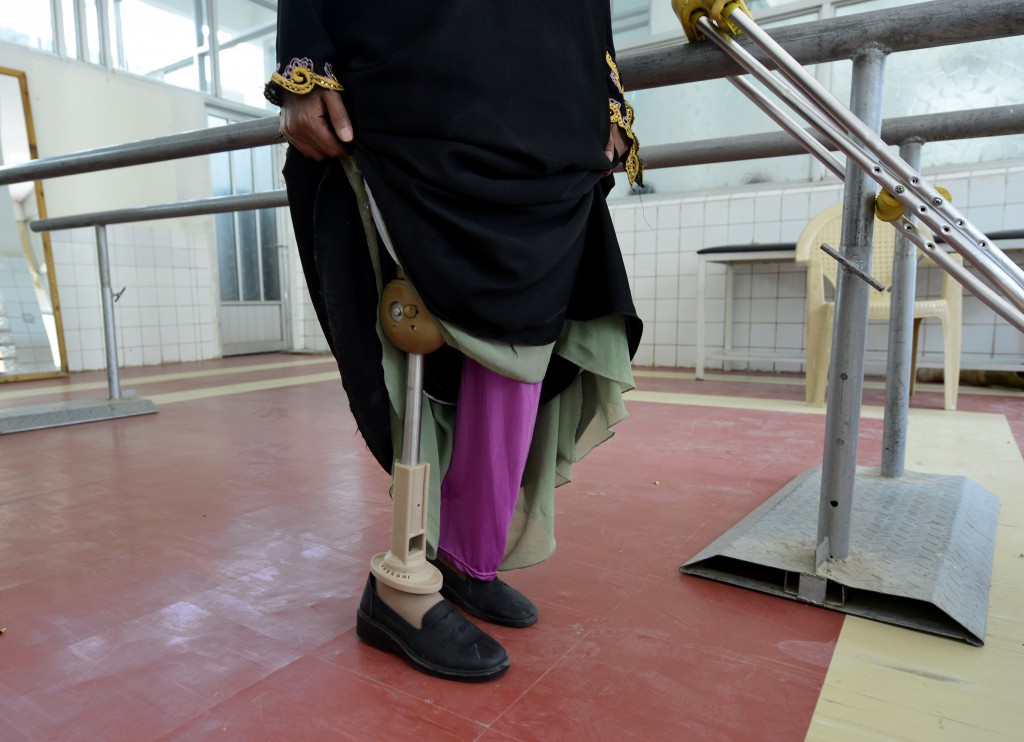 A woman tries out a prosthetic limb at a rehabilitation center in Sana'a, Yemen, in April. According to government statistics, Yemen has cleared 524,000 landmines and explosive shells over the last 10 years. Pope Francis is urging international action to rid the world of landmines, which, he said, prolong war and nurture fear.  (CNS photo/Yahya Arhab, EPA)  