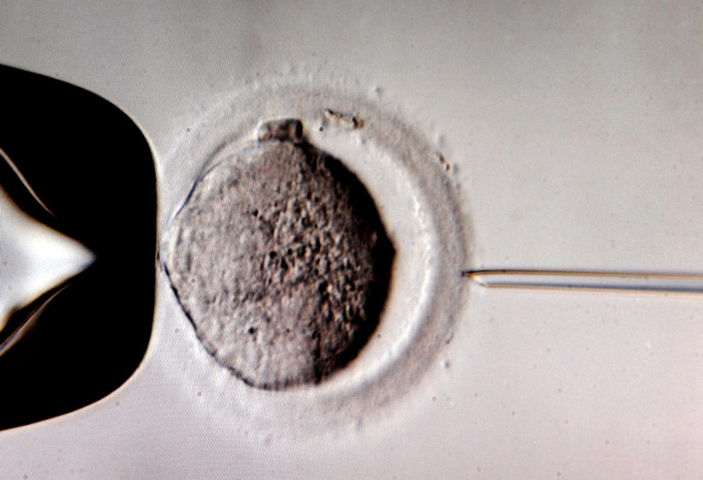 A monitor shows the microinjection of sperm into an egg cell using a microscope at a Leipzig, Germany, in vitro fertilization clinic in this July 2011 file photo. (CNS photo/EPA) 