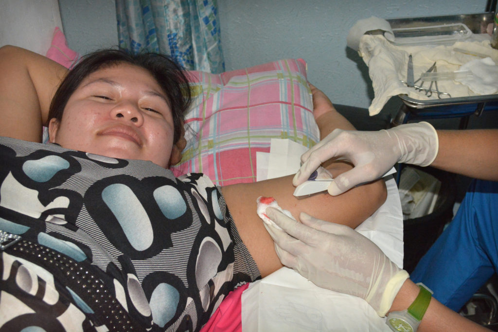 A woman with three children receives a contraceptive implant embedded under her skin at the Likhaan Women's Health Center in Manila, Philippines, Aug. 6. The device prevents pregnancy for three years.  (CNS photo/Simone Orendain) 